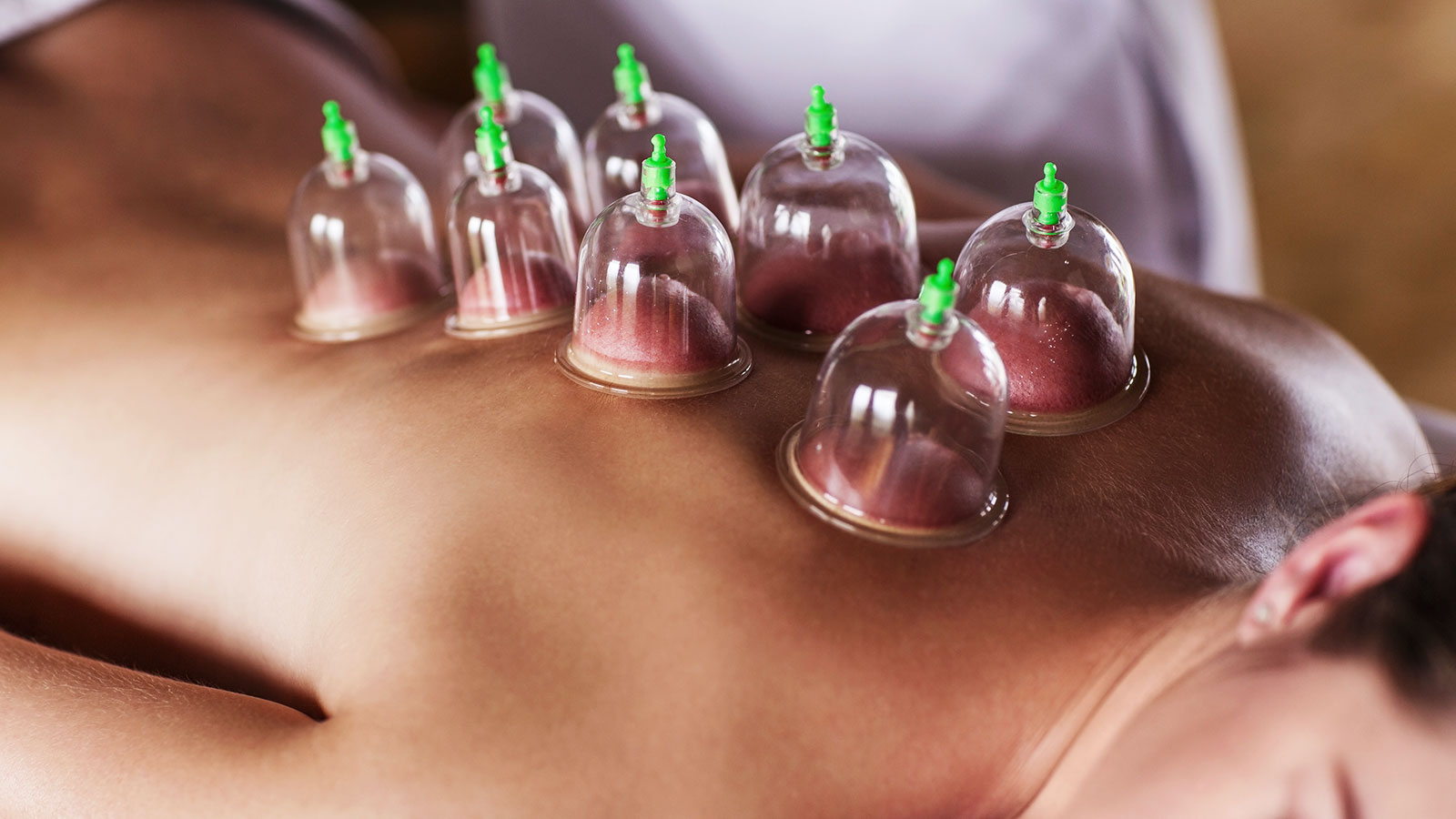 Sports Massage Therapy Service Cupping